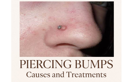 Piercing Bumps Explained — Real Causes & Real Solutions