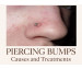 Piercing Bumps Explained — Real Causes...