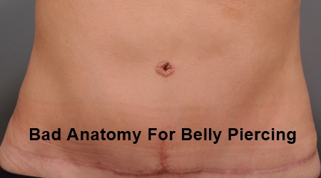 Bad Anatomy For Belly Piercing